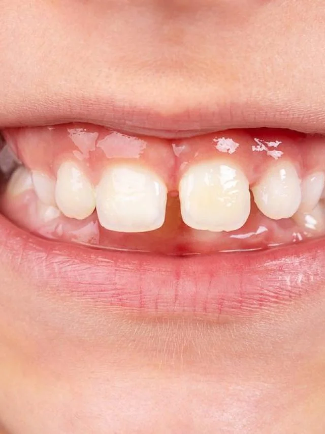 kid-with-gap-in-her-teeth