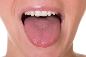 Do you Have a Healthy Tongue? (4 Popular Tongue Diseases)