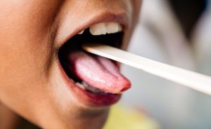 What is Geographic Tongue? | 4 Symptoms to Look For