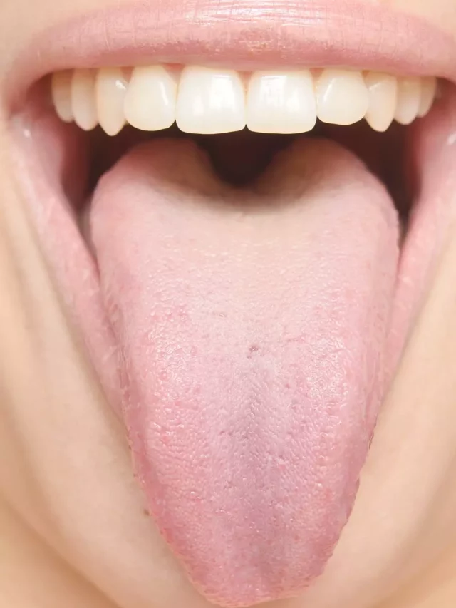 tongue