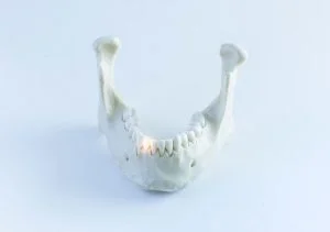 Jaw Bone Cavitation: The 2 Best Treatment Methods