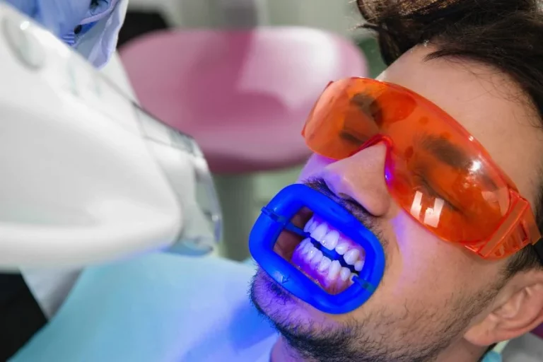 Blanqueamiento Dental