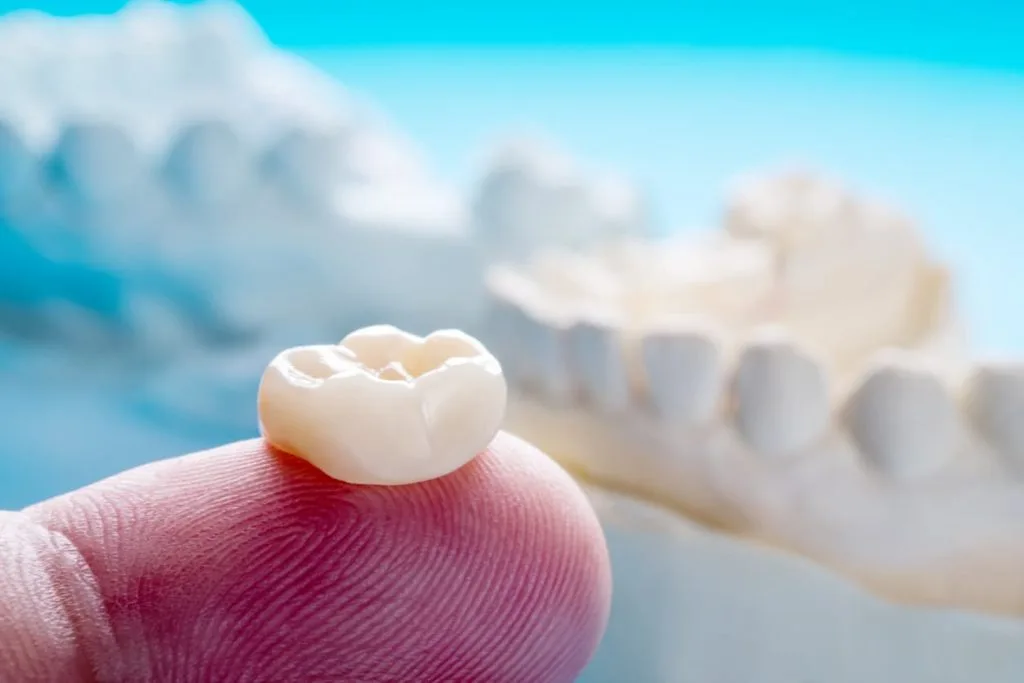 Lesiones Dentales: Guía para una Sonrisa Saludable