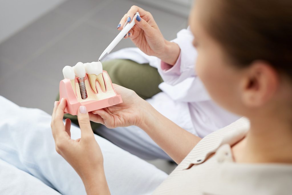explaining tooth implantation