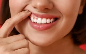 Signs and Symptoms of Gum Disease: 6 Preventive Tips