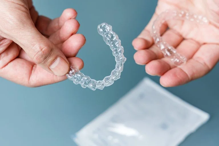 Clear Aligners