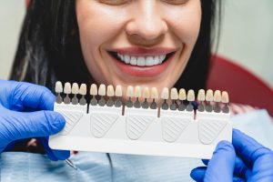 Blanqueamiento Dental Profesional
