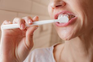 Oral Hygiene Instructions 4 Woman Brushing Teeth