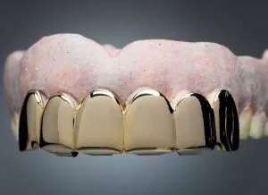 dental-grills
