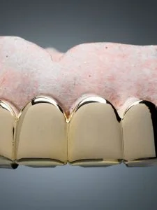 dental-grills