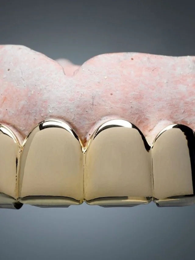 dental-grills