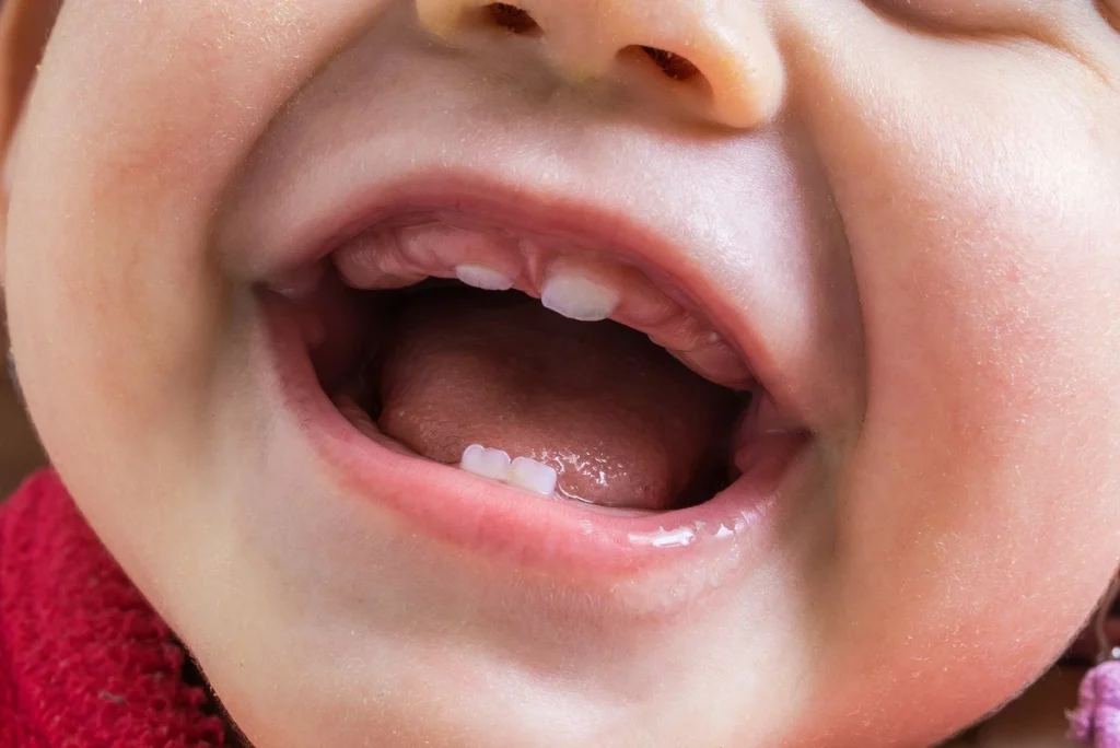 Erupción de Dientes de Niños