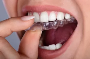 Corrección de mandíbula y mordida