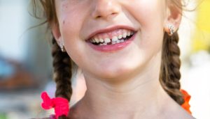 Toothless happy smile of a girl with a fallen lower milk tooth close-up. Changing teeth to molars in