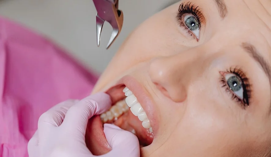 woman having a tooth extraction