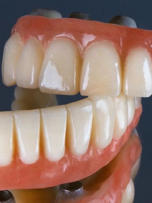 permanent-dental-prostheses