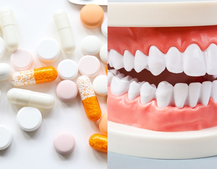nifedipine-and-dental-health