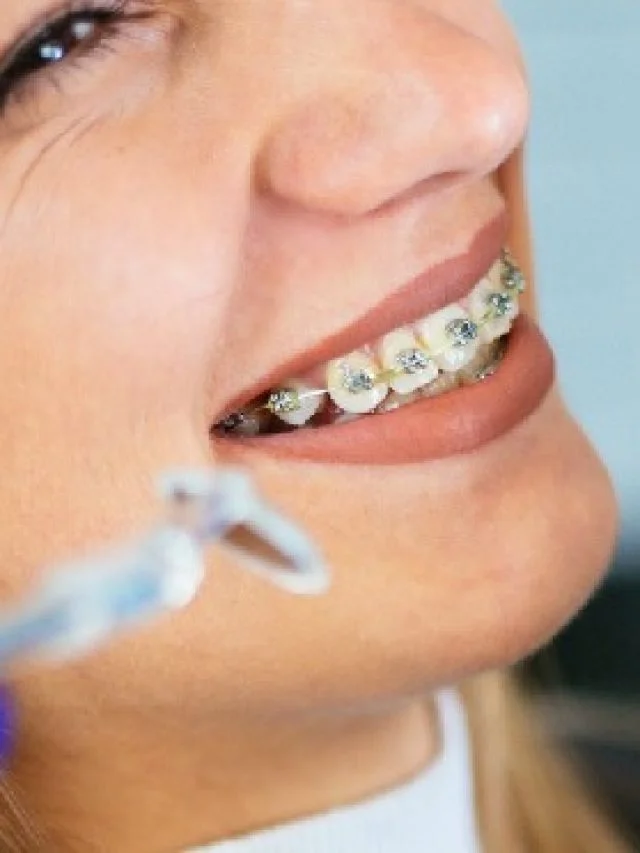 girl showing her braces