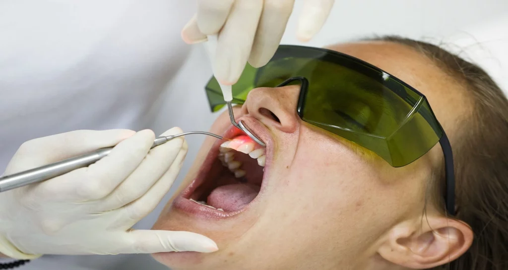 Laser gum surgery