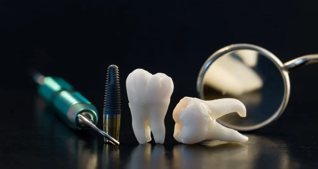 wisdom tooth socket