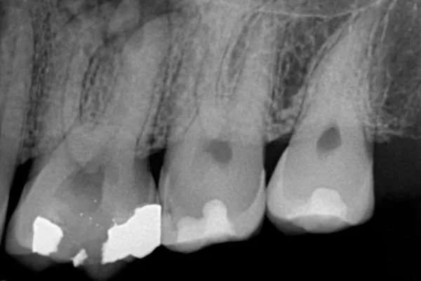Radiografías Dentales