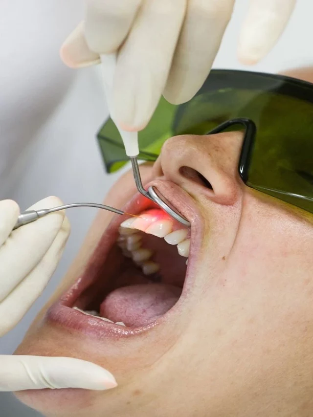 Laser gum surgery