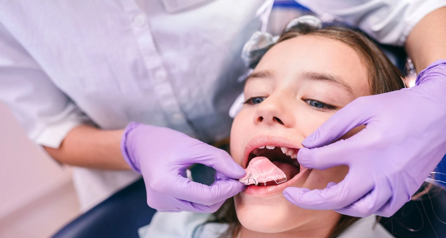 using orthodontic treatment