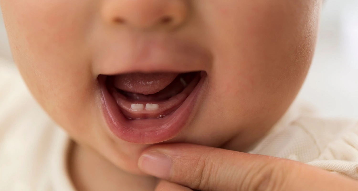 close up look at natal teeth