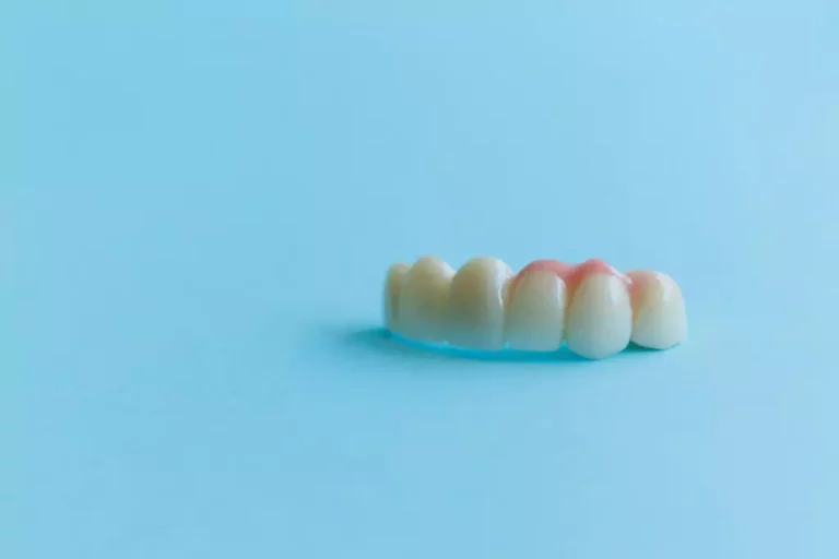 Corona y Puentes Dentales