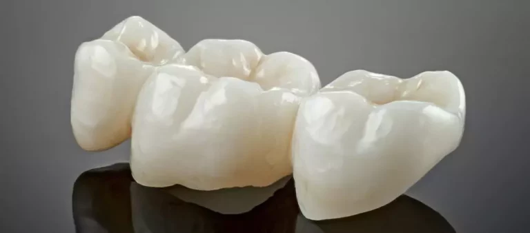 Restauración de Coronas Dentales