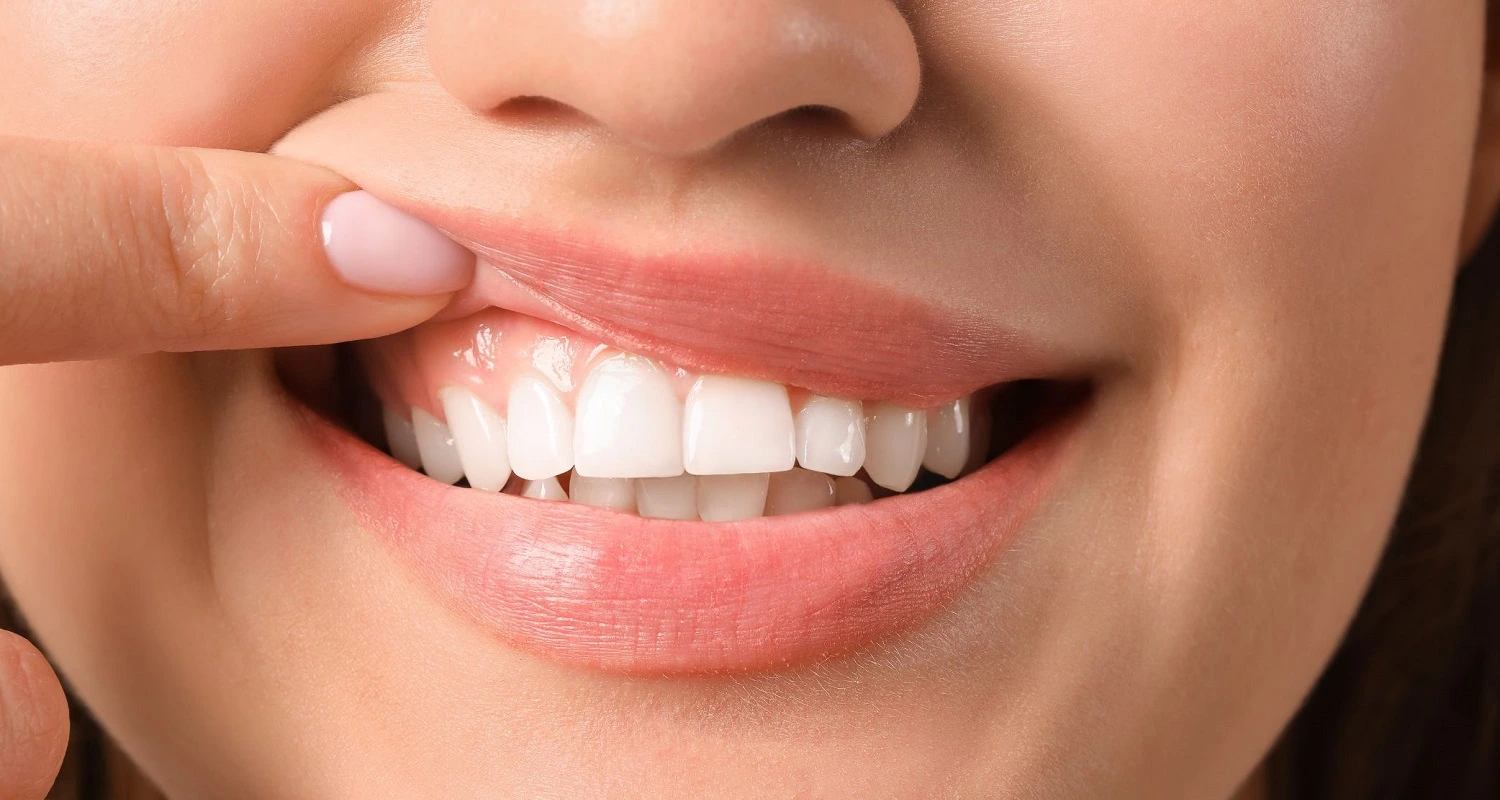 benefits of gum contouring
