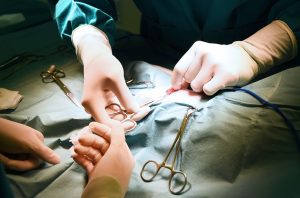 ¿Qué Es La Cirugía De ATM?: 6 Opciones Quirúrgicas Definitivas