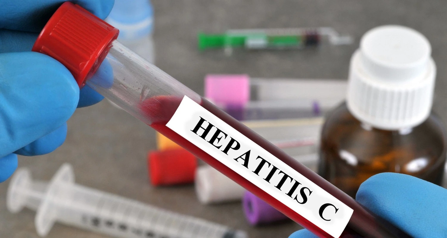 blood sample for hepatitis c