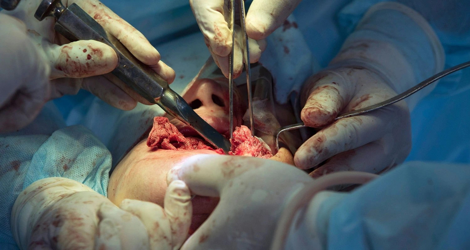 close-up maxillofacial surgery