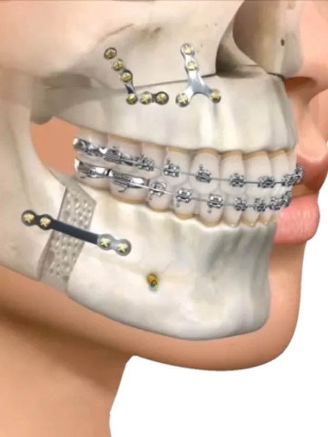 Cirugía Maxilofacial