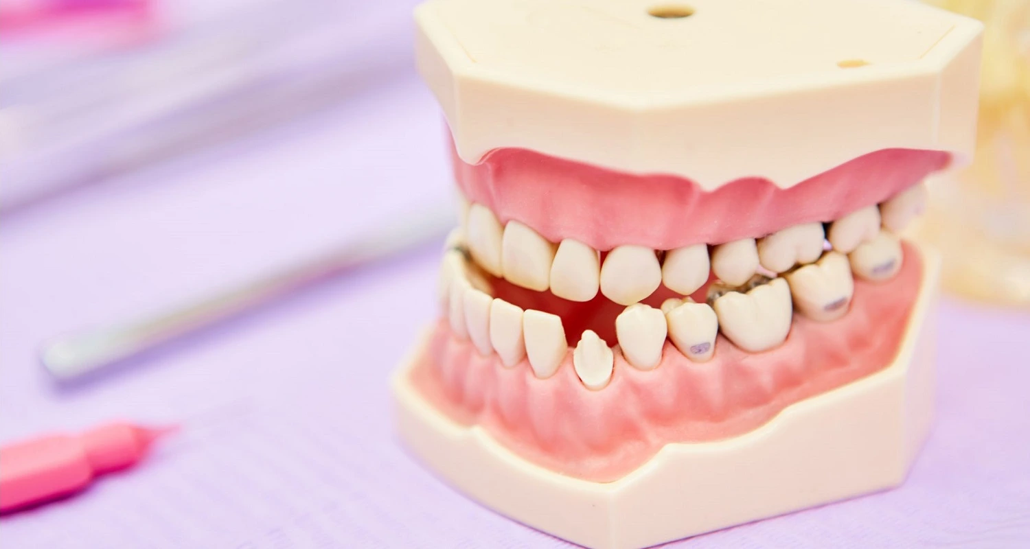 treatments for malocclusion