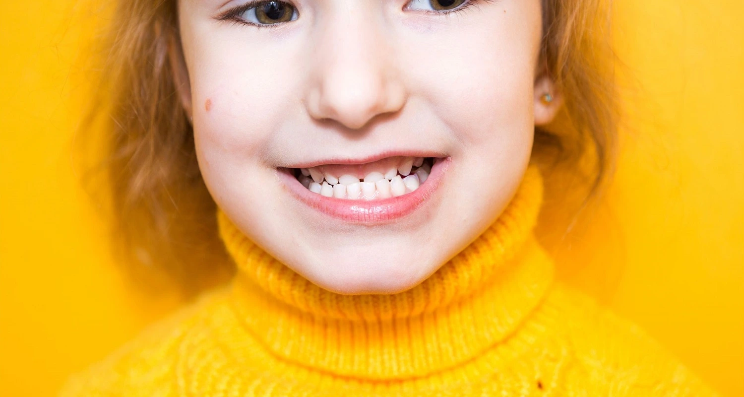 girl having a malocclusion