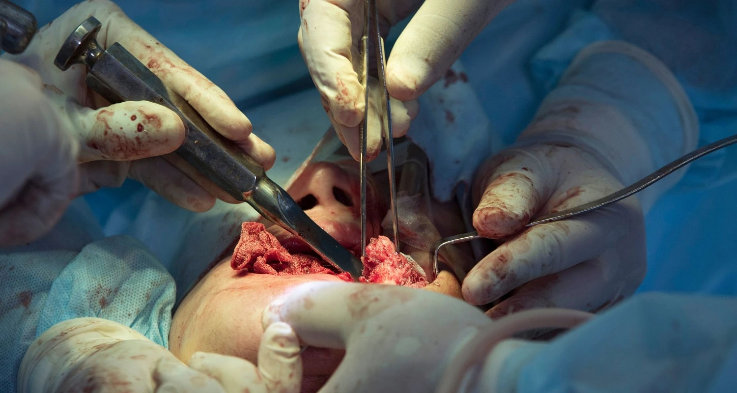 maxillofacial surgery