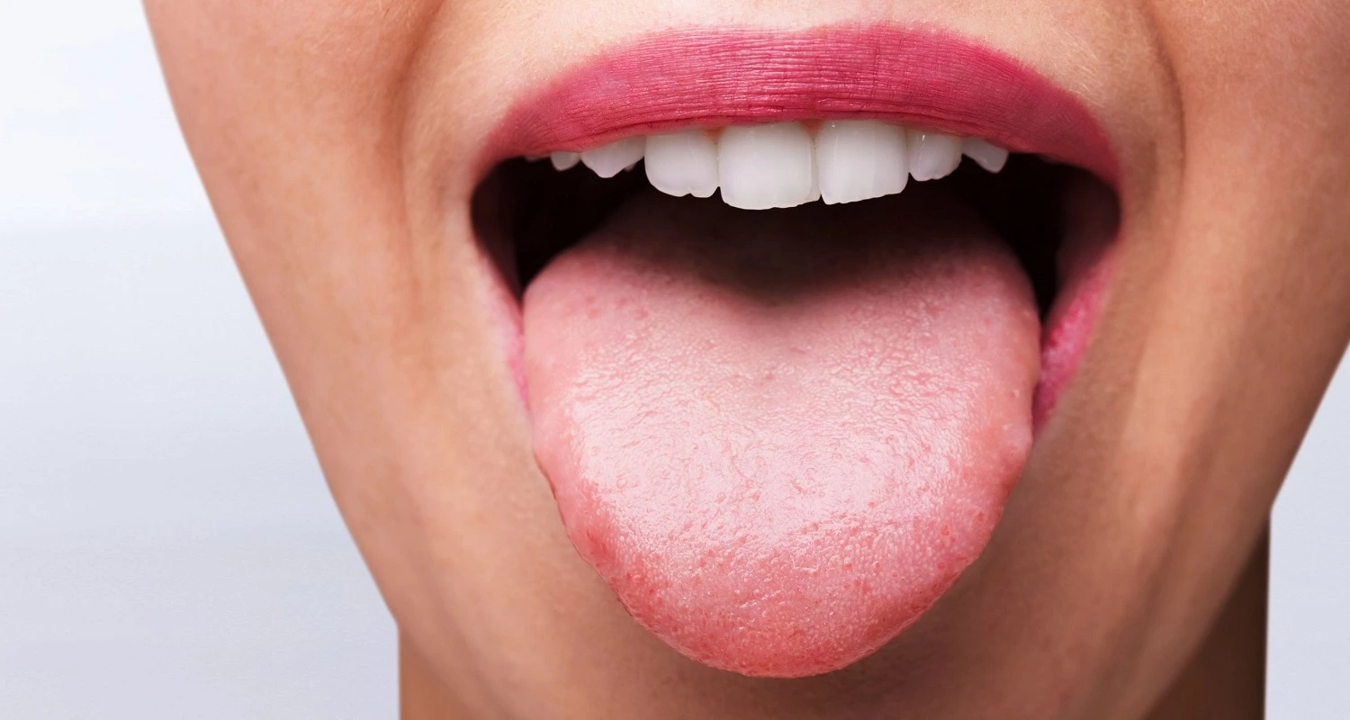 woman is showing her healthy tongue