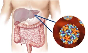 ¿La enfermedad hepática puede causar caries? (5 causas y mecanismos)