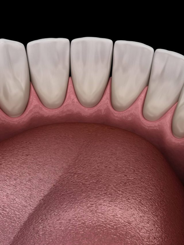 9 Key Reasons and Symptoms What is Torus Mandibularis?
