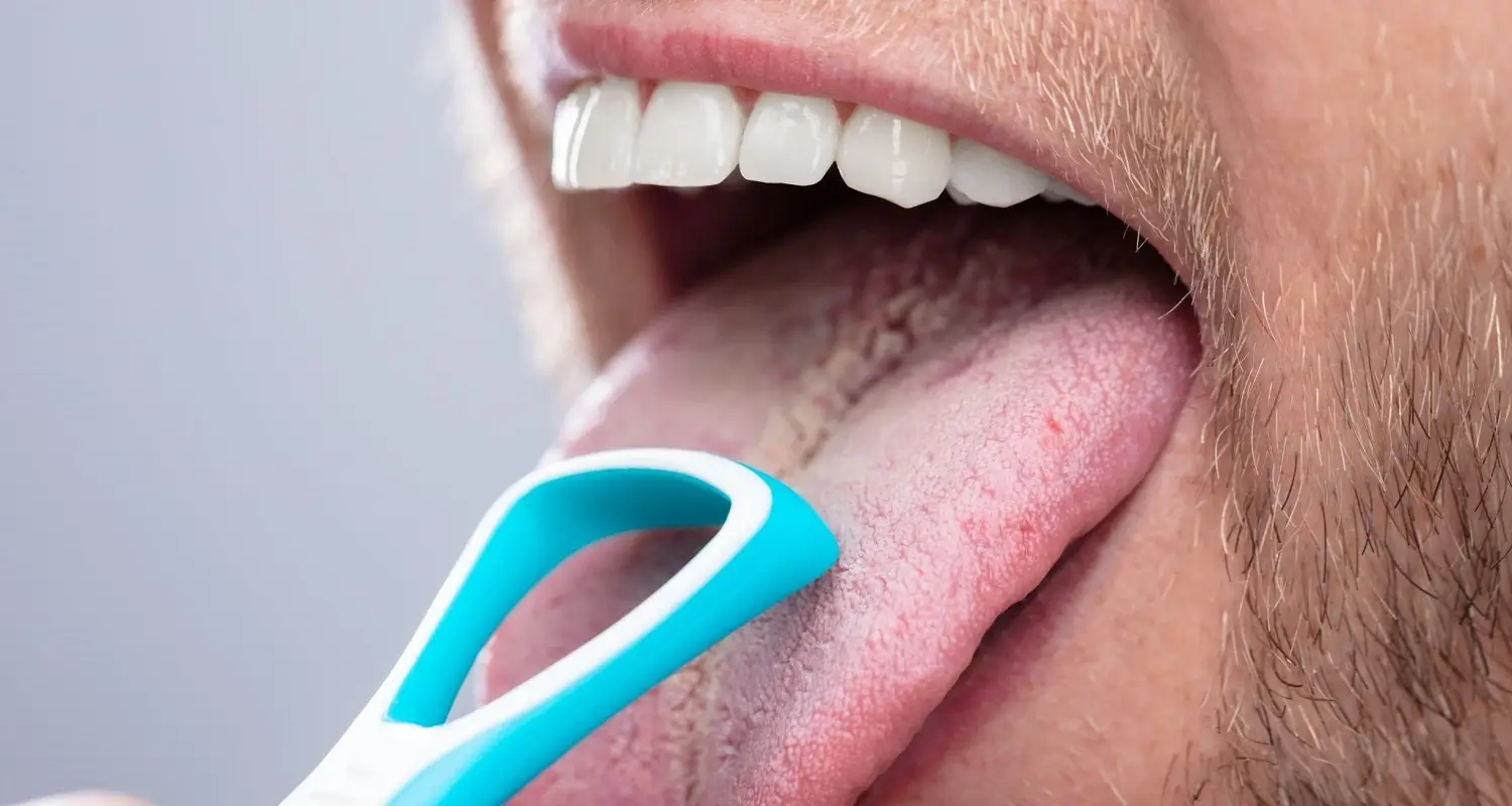 What is Fissured Tongue? (Causes, Symptoms & 7 Useful Tips)