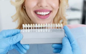 Blanqueamiento dental DIY