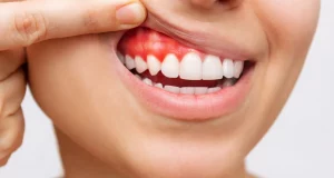 Cómo revertir la periodontitis