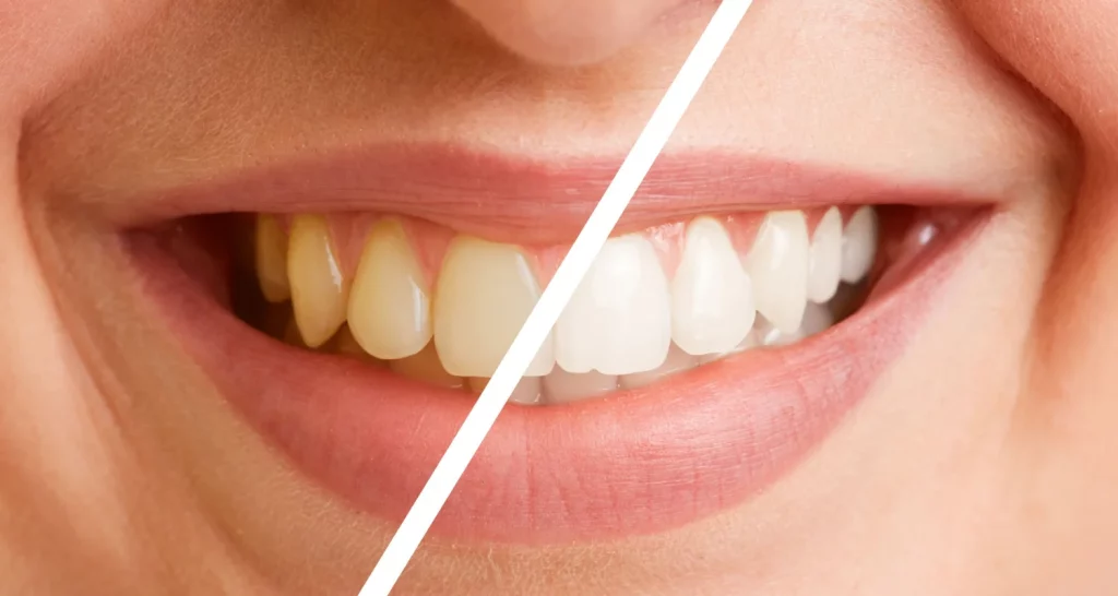 What is the Importance of Maintaining Good Oral Hygiene?