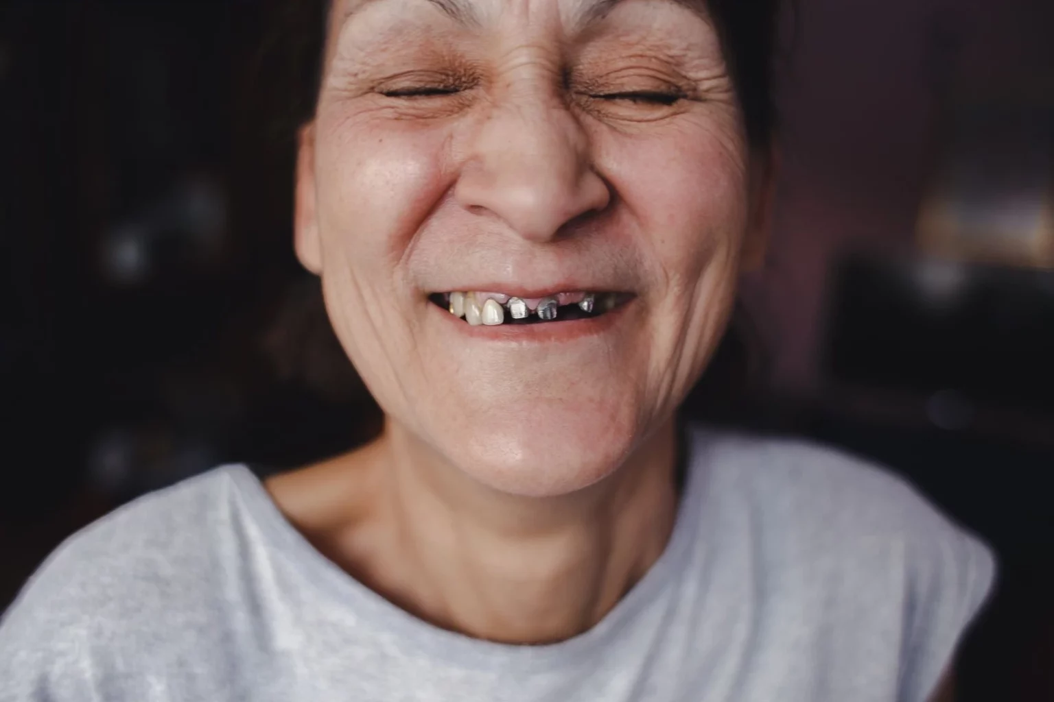 Enfermedades Dentales En Ancianos