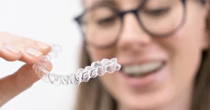 clear aligners