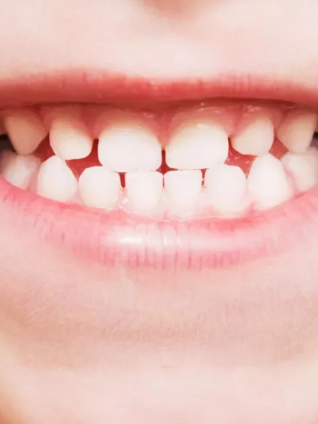 Teeth development in children