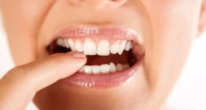 Dientes flojos y enfermedad de las encías || Loose Teeth Due To Gum Disease