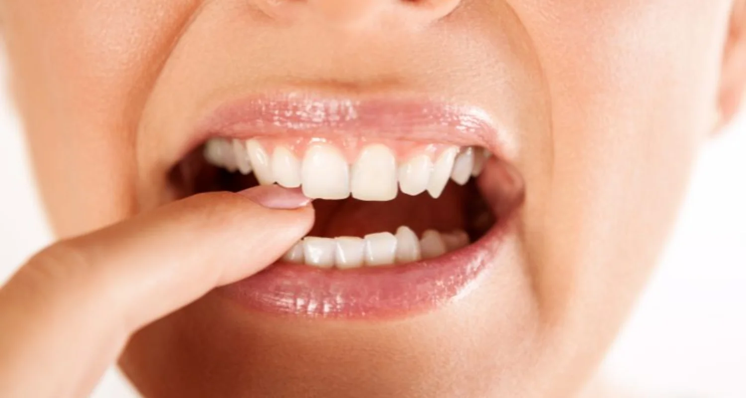 Dientes flojos y enfermedad de las encías || Loose Teeth Due To Gum Disease